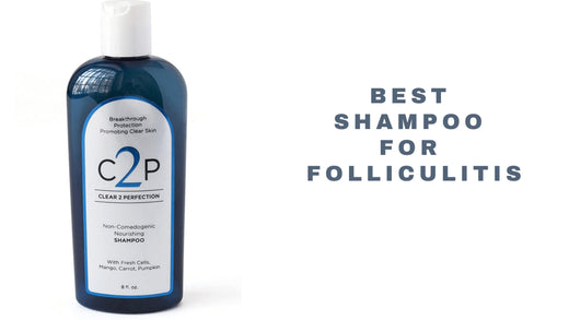 12 Best Shampoo For Folliculitis 2026