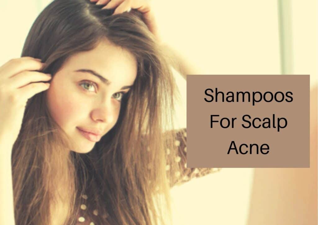 Shampoos for scalp acne