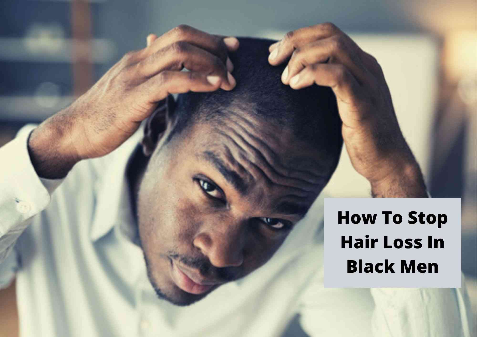 How To Prevent Hair Loss For Black Men 2023 | Treatments For Thinning And  Male Pattern Baldness - Hair Everyday Review