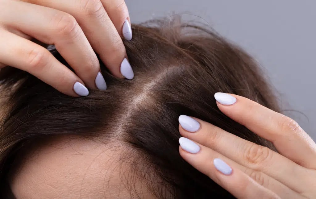 Does Biotin Stop Hair Loss
