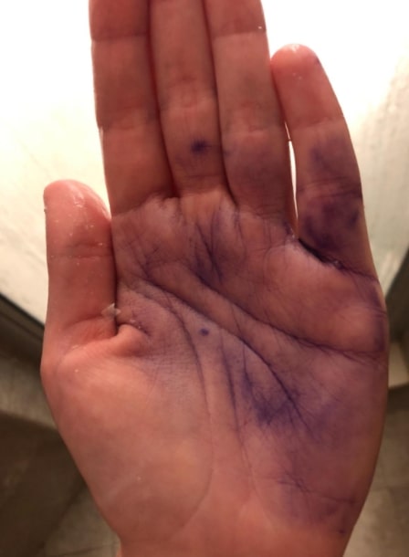 does purple shampoo stain hands