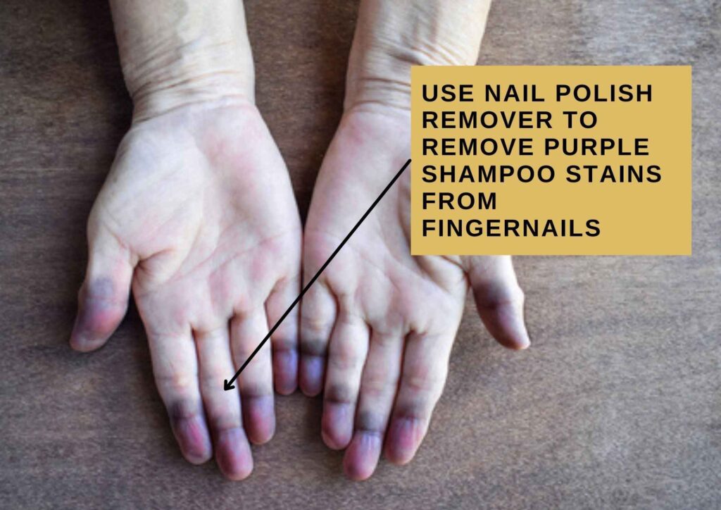 how to remove purple shampoo stain from nails