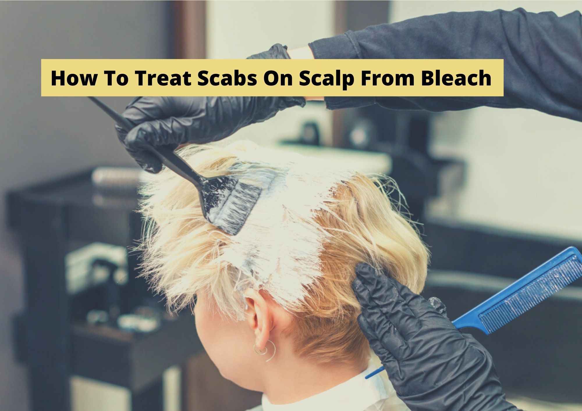 6 Tips On How To Treat Scabs On Scalp From Bleach 2023 | Treatments For  Bleach Burns, Sores, Irritation - Hair Everyday Review