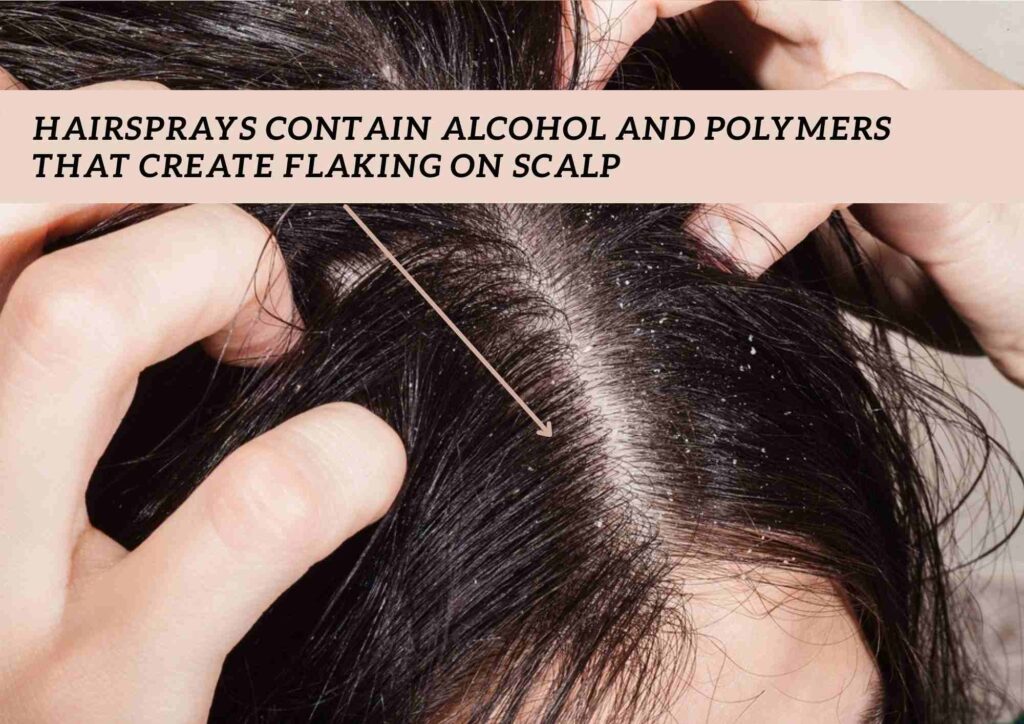 hairspray buildup on scalp