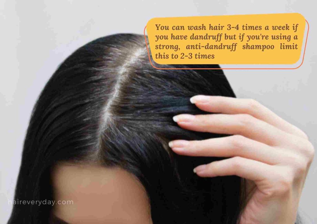 how often should you wash your hair if you have dandruff