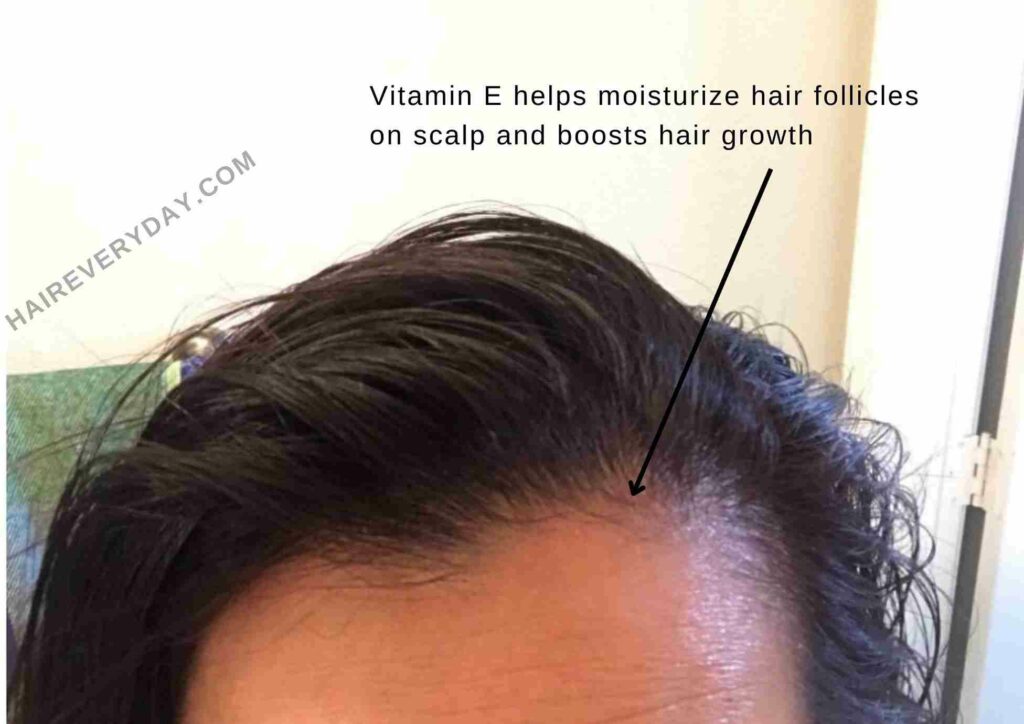 vitamin e on hair overnight