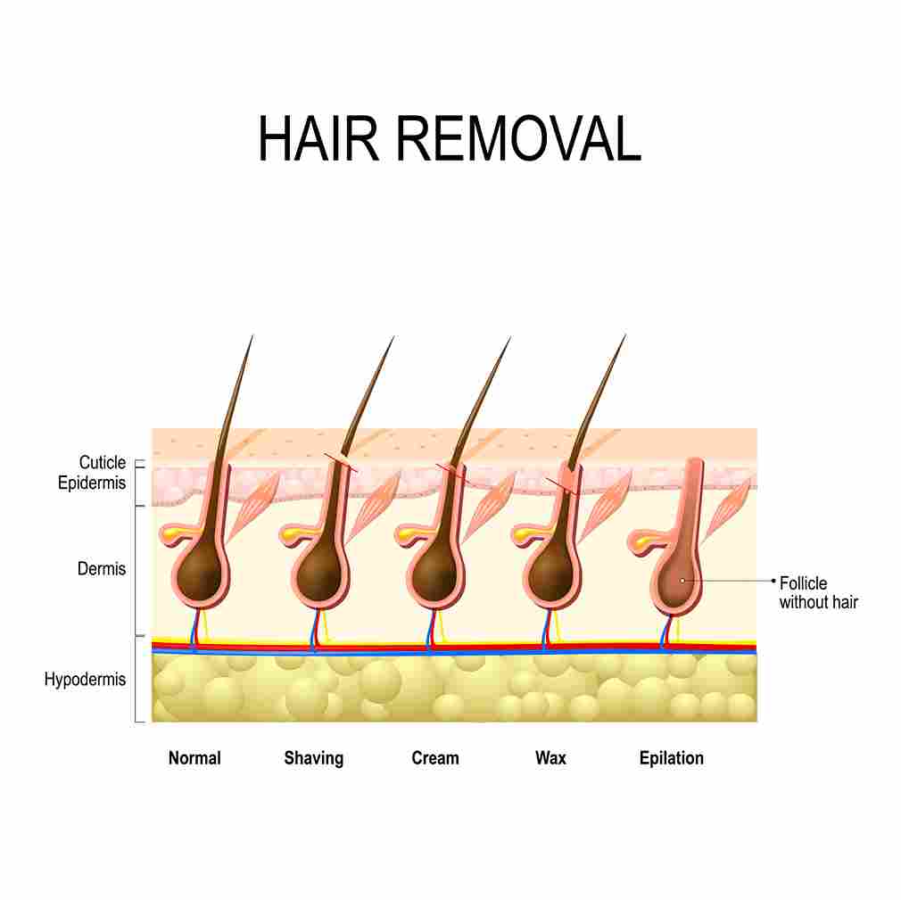 hair removal for private parts female
