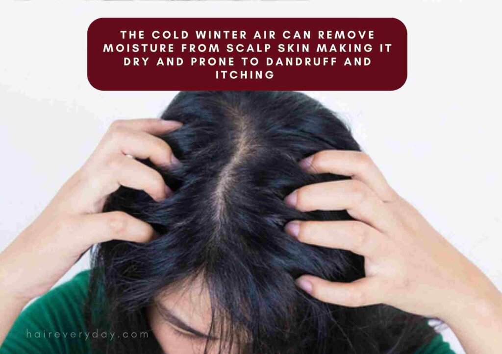 What Are Some Winter Hair Problems | And 6 Ways You Can Prevent Them! - Hair  Everyday Review