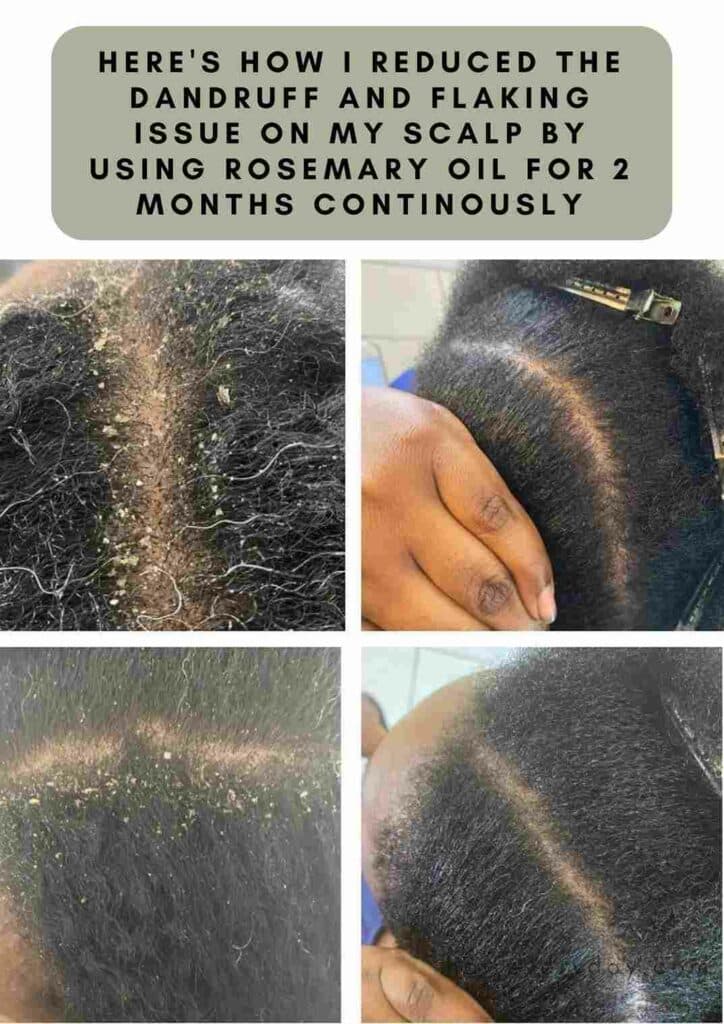 rosemary oil for hair growth before and after