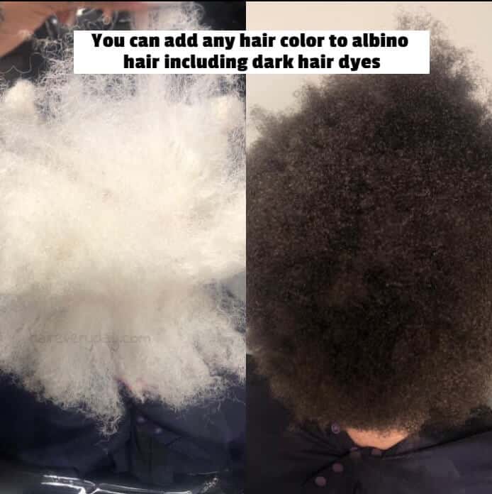 what happens if an albino dye their hair