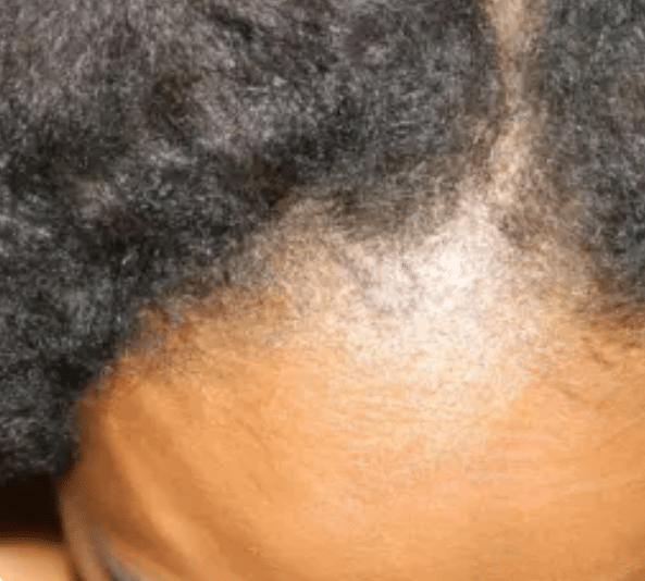 women with low porosity hair 