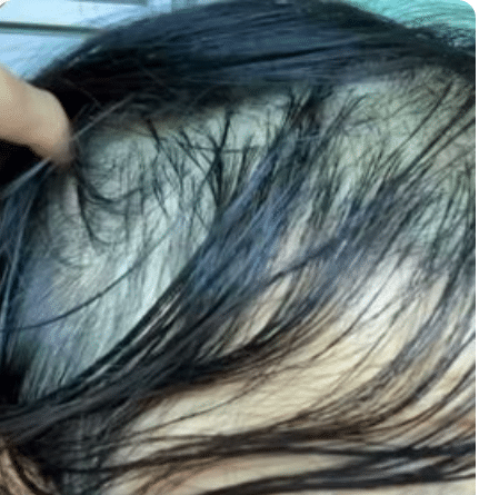 How to Stop Sweating In Your Hair?
