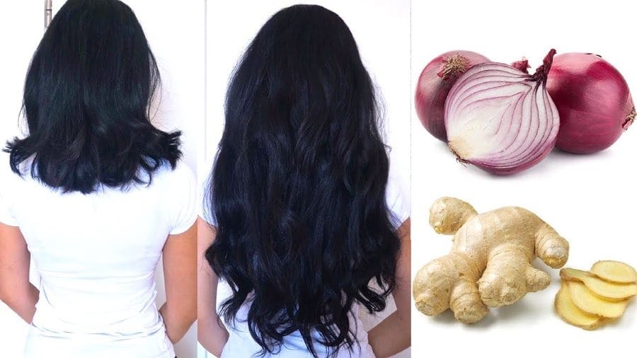 can i mix ginger garlic and onion for hair growth